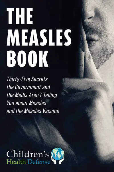 The Measles Book book cover