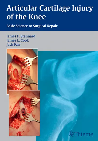 Articular Cartilage Injury of the Knee: Basic Science to Surgical Repair book cover