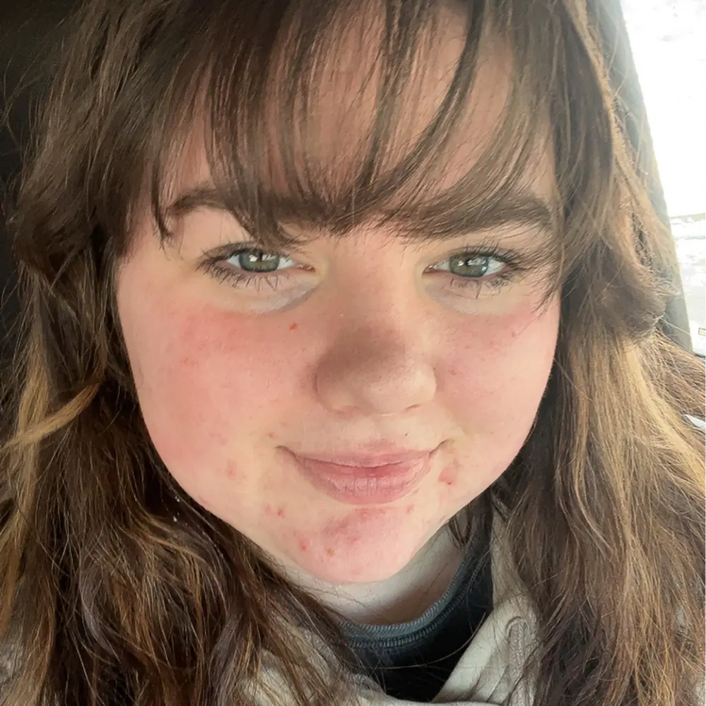 ashlynn profile pic